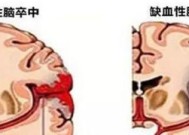 复印机重影的原因及解决方法（探索复印机重影问题的根源）