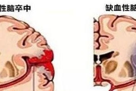 复印机重影的原因及解决方法（探索复印机重影问题的根源）