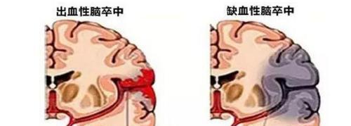 复印机重影的原因及解决方法（探索复印机重影问题的根源）  第1张